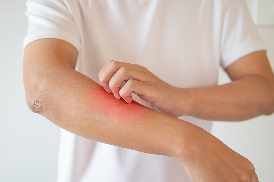 skt, sk텔레콤, 모기박멸, 모기퇴치기, 모기퇴치앱, 모기기피체, 모기퇴치용품