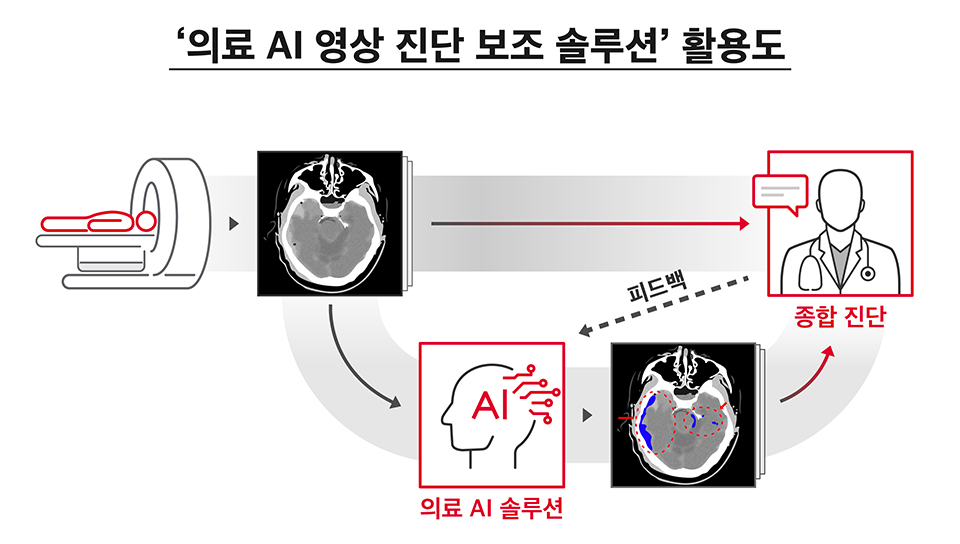 SKT, 인공지능, AI, 초협력, AI영상진단, 의료영상진단